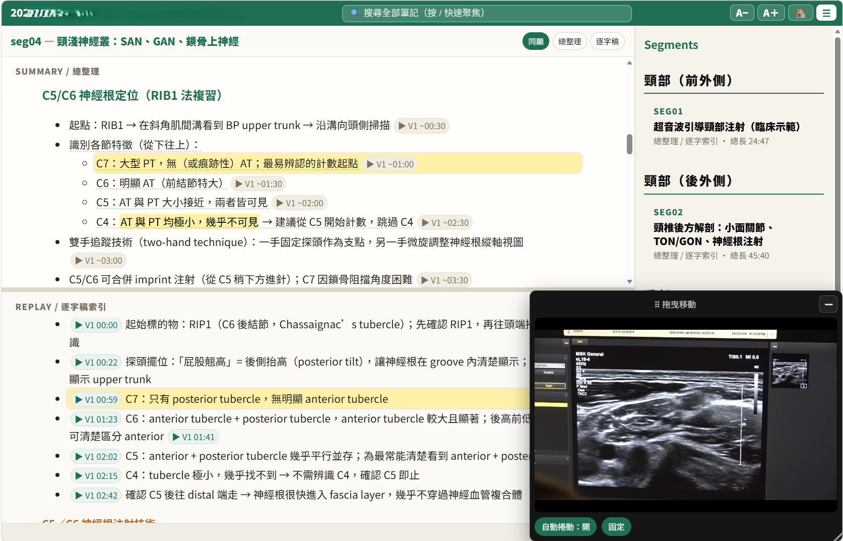 同步視圖:總整理與逐字稿索引並排,浮動影片視窗可拖曳,高亮條目跟著影片走